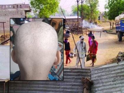 Maharashtra Hair Loss Mystery: 5 Key Facts About the Outbreak Shaking Villages